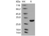 Recombinant Mouse UCHL1/PGP9.5 Protein (His Tag)(Active)