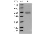 Recombinant Mouse OMGP/OMG Protein (aa 1-245, His Tag)