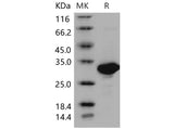 Recombinant Mouse Carbonic Anhydrase II/CA2 Protein (His Tag)(Active)