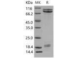 Recombinant Mouse E-Cadherin/CDH1 Protein (His Tag)(Active)