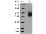 Recombinant Mouse IFNGR2 Protein (His Tag)