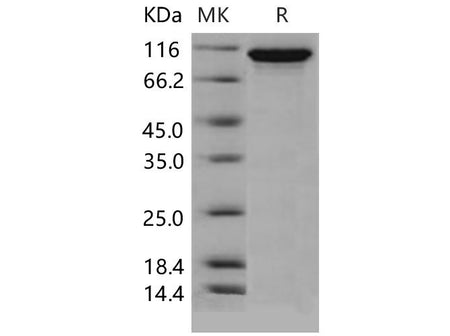 Recombinant Mouse Autotaxin/ENPP2 Protein (His Tag)