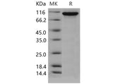 Recombinant Mouse Autotaxin/ENPP2 Protein (His Tag)