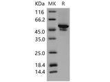 Recombinant Mouse Carbonic Anhydrase IX/CA9 Protein (His Tag)(Active)