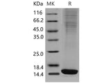 Recombinant Mouse FABP4/A-FABP Protein (HEK293, His Tag)