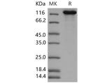 Recombinant Mouse CNTNAP2/CASPR2 Protein (His Tag)(Active)