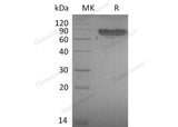 Recombinant Mouse ICAM-2/CD102 Protein (Active)