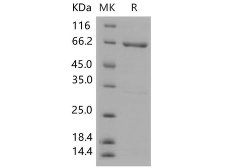 Recombinant Mouse MEK4/MAP2K4 Protein (His & GST Tag)