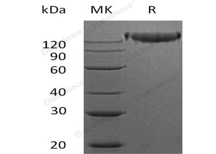 Recombinant Mouse Semaphorin-4D/SEMA4D Protein (His Tag)(Active)