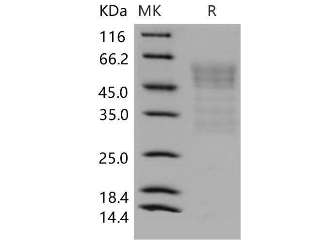 Recombinant Mouse Syndecan-1/SDC1 Protein (His Tag)