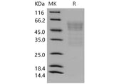 Recombinant Mouse Syndecan-1/SDC1 Protein (His Tag)
