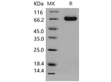 Recombinant Mouse DLL4 Protein (His Tag)(Active)