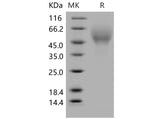 Recombinant Mouse CD200R4/CD200RLa Protein (His Tag)