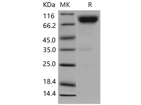 Recombinant Mouse CD200R4/CD200RLa Protein (Fc Tag)