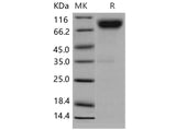 Recombinant Mouse CD200R4/CD200RLa Protein (Fc Tag)