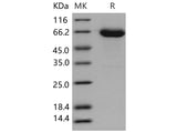 Recombinant Mouse EphA6/EHK-2 Protein (His Tag)(Active)