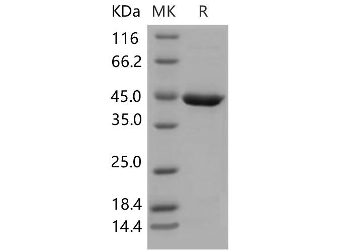 Recombinant Mouse SerpinB10 Protein (His Tag)