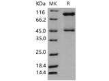 Recombinant Mouse SerpinB3/SCCA1 Protein (His Tag)