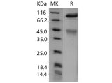 Recombinant Mouse c-MET/HGFR Protein (His Tag)(Active)