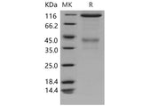Recombinant Mouse c-MET/HGFR Protein (Fc Tag)(Fc Tag)(Active)