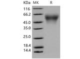 Recombinant Mouse Carboxylesterase 2E/CES2E Protein (His Tag) (Active)