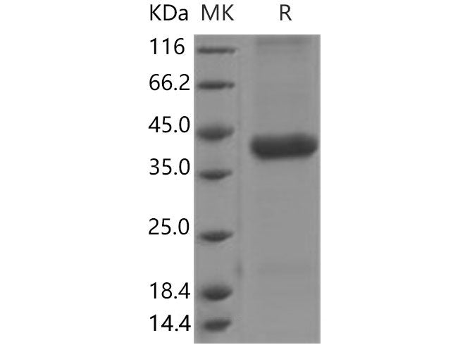 Recombinant Mouse Cathepsin H/CTSH Protein (aa 21-333, His Tag)