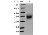 Recombinant Mouse Activin RIIA/ACVR2A Protein (His Tag)(Active)