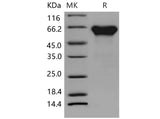 Recombinant Mouse Activin RIIA/ACVR2A Protein (His & Fc Tag)(Active)