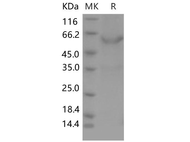 Recombinant Mouse Meteorin/METRN Protein (Fc Tag)
