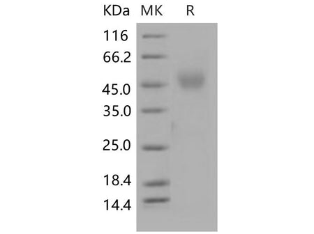 Recombinant Mouse NEGR1 Protein (His Tag)
