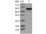 Recombinant Mouse HSPD1/HSP60 Protein (His Tag)
