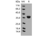 Recombinant Mouse EpCAM/TROP-1 Protein (His Tag)