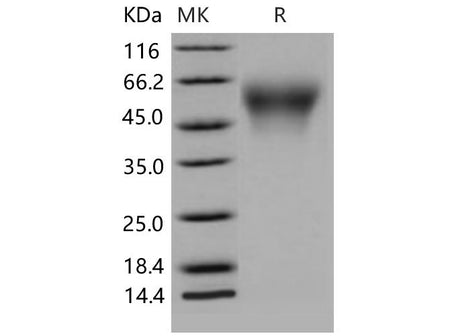 Recombinant Mouse CD34 Protein (His Tag)(Active)