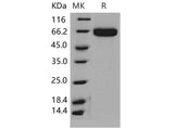Recombinant Mouse EphA2 Protein (His Tag)(Active)