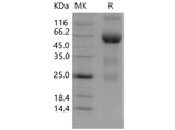 Recombinant Mouse VEGFR3/FLT4 Protein (Fc Tag)(Active)