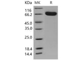 Recombinant Mouse EphB4/HTK Protein (His Tag)(Active)