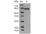 Recombinant Mouse EphB3/HEK2 Protein (His Tag)(Active)
