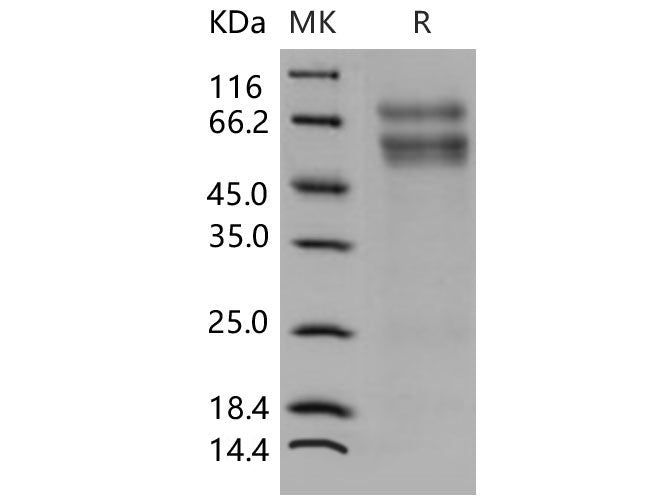 Recombinant Mouse CHST3/C6ST-1 Protein (His Tag)