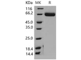 Recombinant Mouse EphA4/HEK8 Protein (His Tag)(Active)