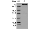 Recombinant Mouse EphA4/HEK8 Protein (Fc Tag)(Active)