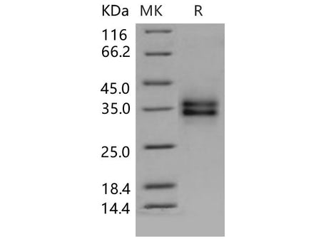 Recombinant Mouse FOLR1 Protein (aa 1-231, His Tag)
