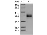 Recombinant Mouse FOLR1 Protein (aa 1-231, His Tag)