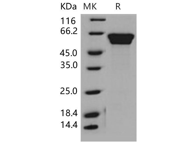 Recombinant Mouse Fetuin-B/FETUB Protein (His Tag)