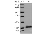 Recombinant Mouse CDNF/ARMETL1 Protein (His Tag)
