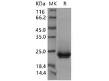 Recombinant Mouse Frizzled-10/FZD10 Protein (His Tag)