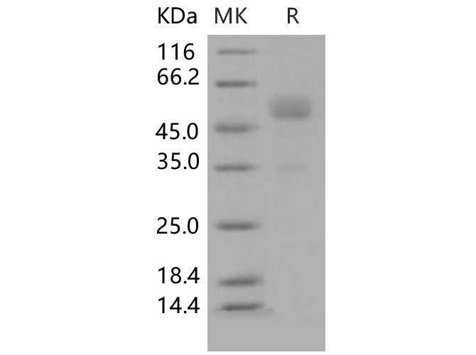 Recombinant Mouse Frizzled-10/FZD10 Protein (Fc Tag)
