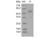 Recombinant Mouse Frizzled-10/FZD10 Protein (Fc Tag)