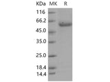 Recombinant Mouse SerpinB12/SERPINB12 Protein (His Tag)