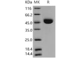 Recombinant Mouse Cathepsin E/CTSE Protein (aa 1-397, His Tag)