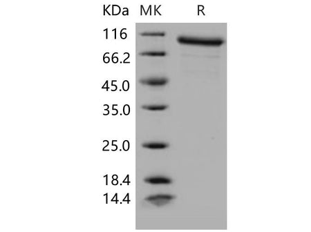 Recombinant Mouse MMP-9 Protein